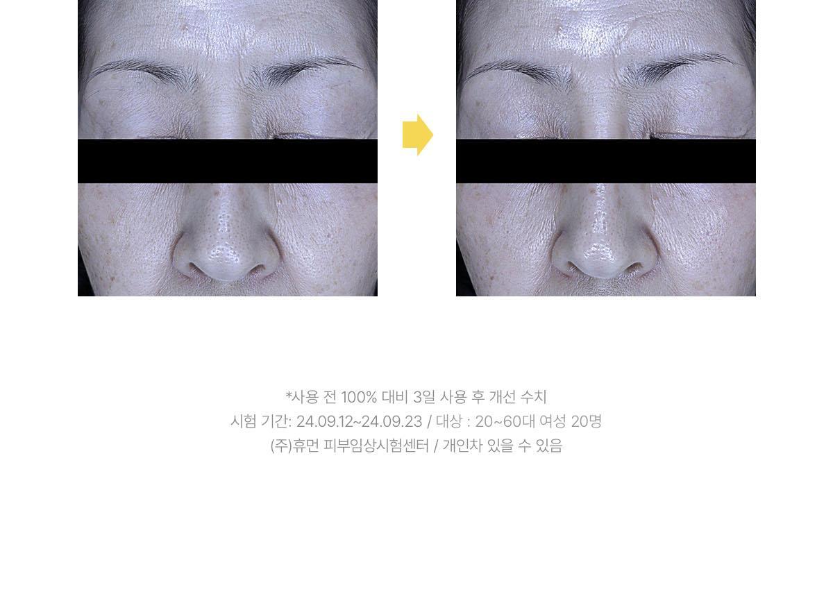 vita_mask_07.jpg?created=202503151727